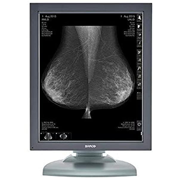 Barco Coronis MFGD-5421 - Monitor de Diagnóstico de Mamografía Digital (Reacondicionado) K9601667-cr