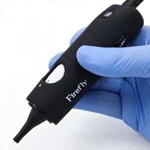 Firefly DE500 Otoscopio de video digital para telemedicina y audiología (FDA y CE)